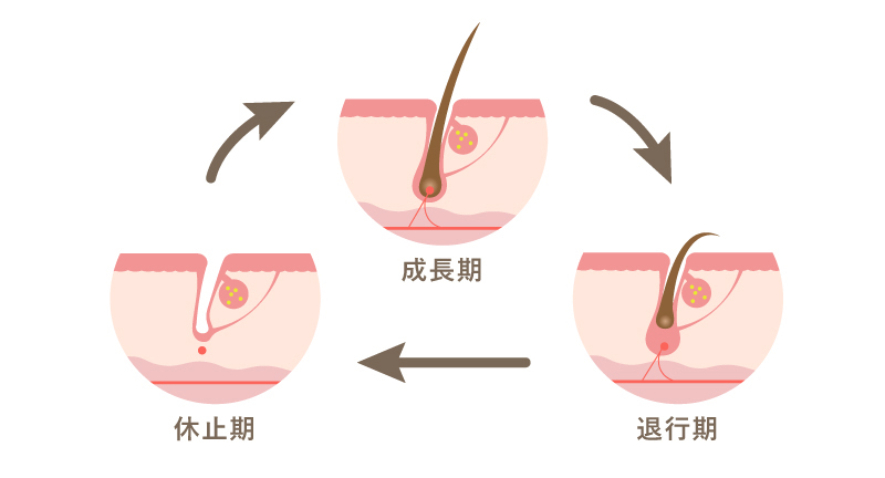 浦和のオジスキンクリニック- OZI式医療レーザ脱毛