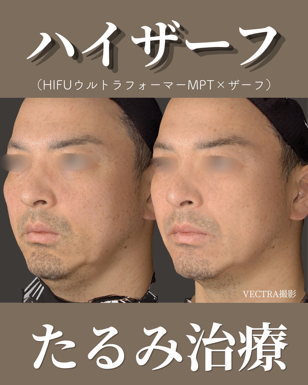 症例2