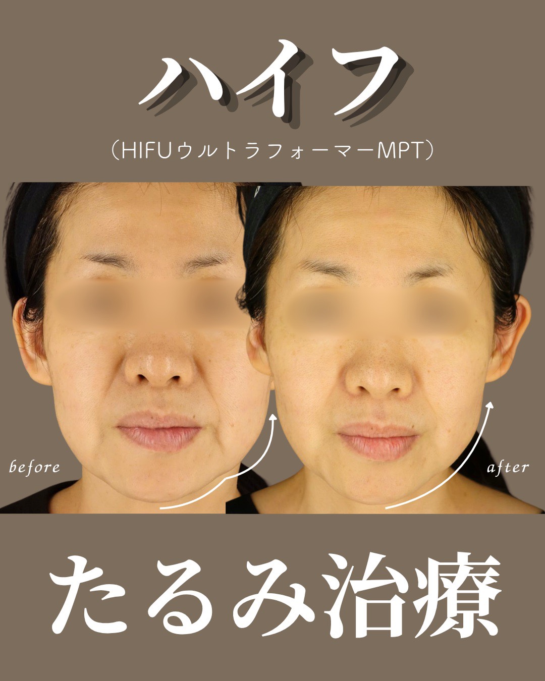 症例1