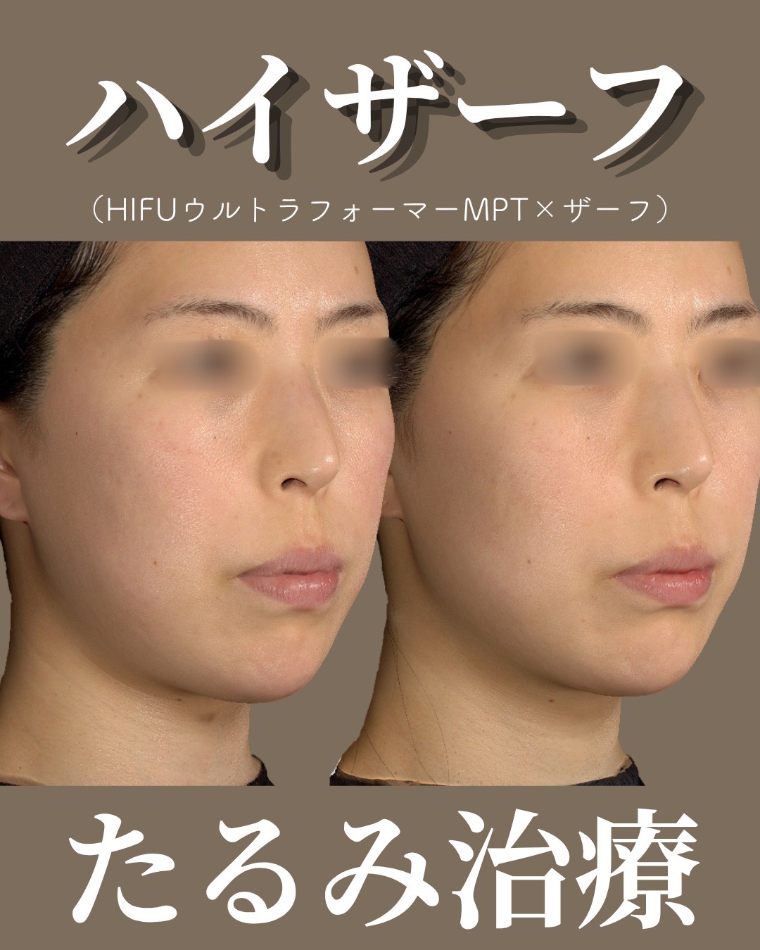 症例2