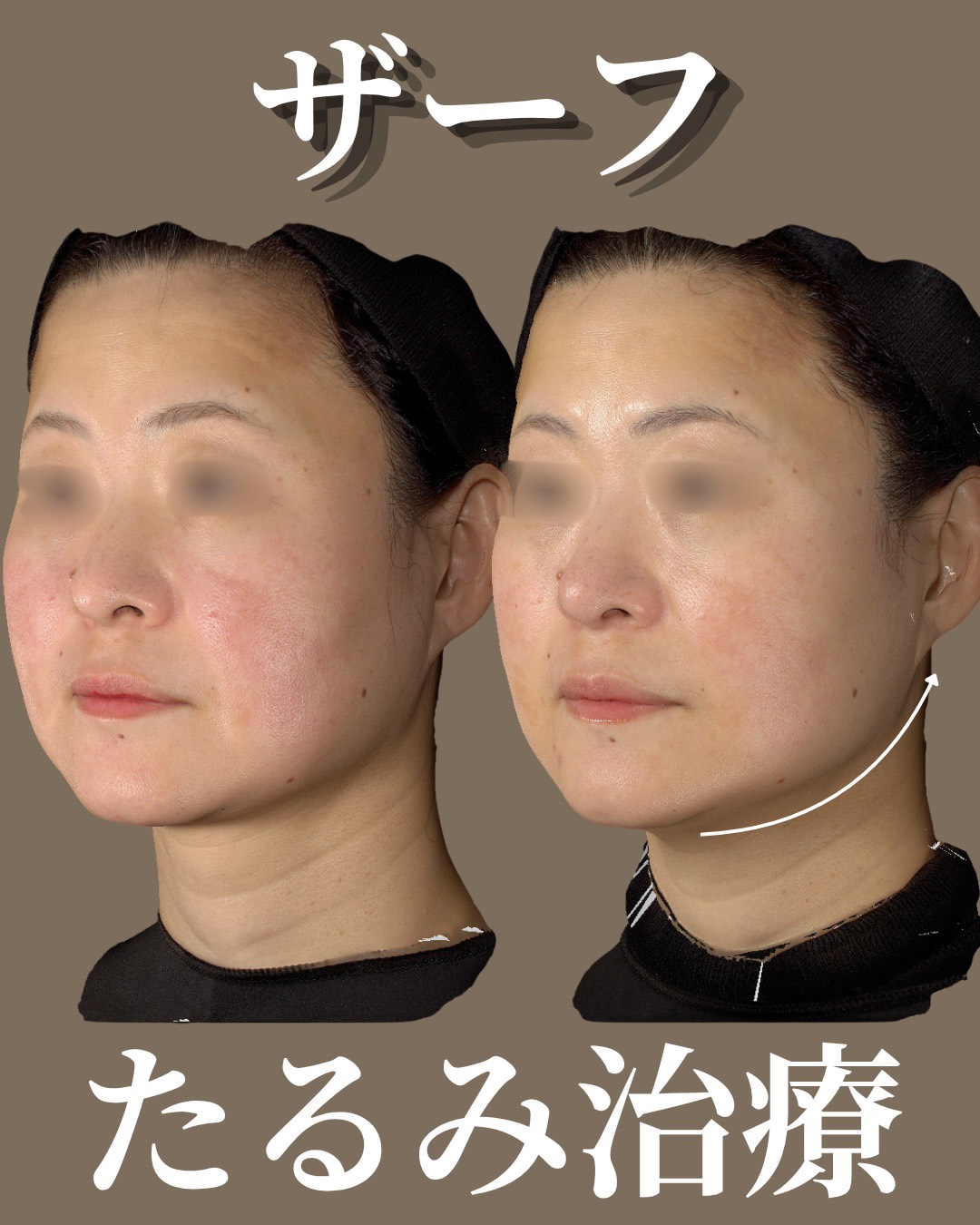 症例6
