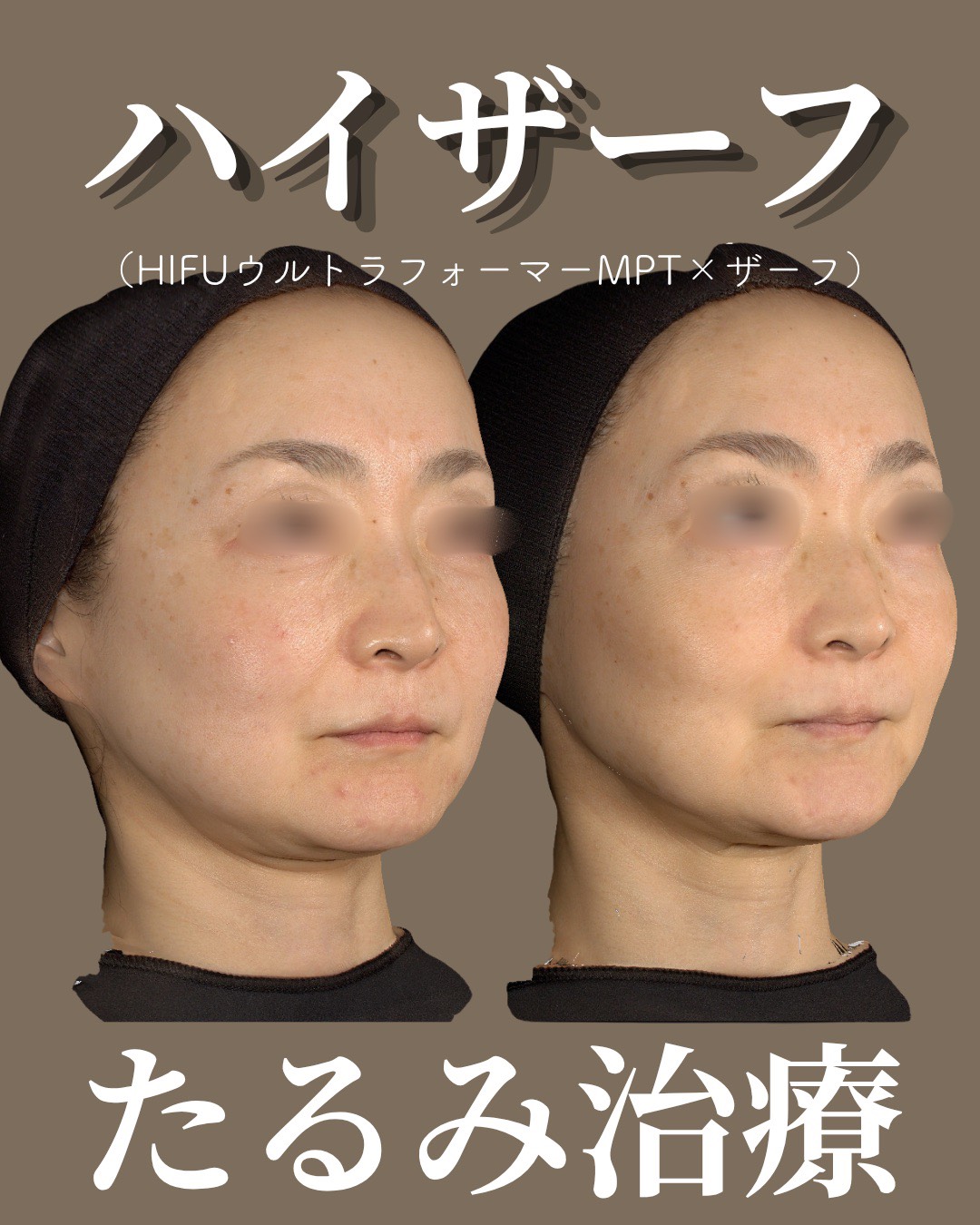 症例3