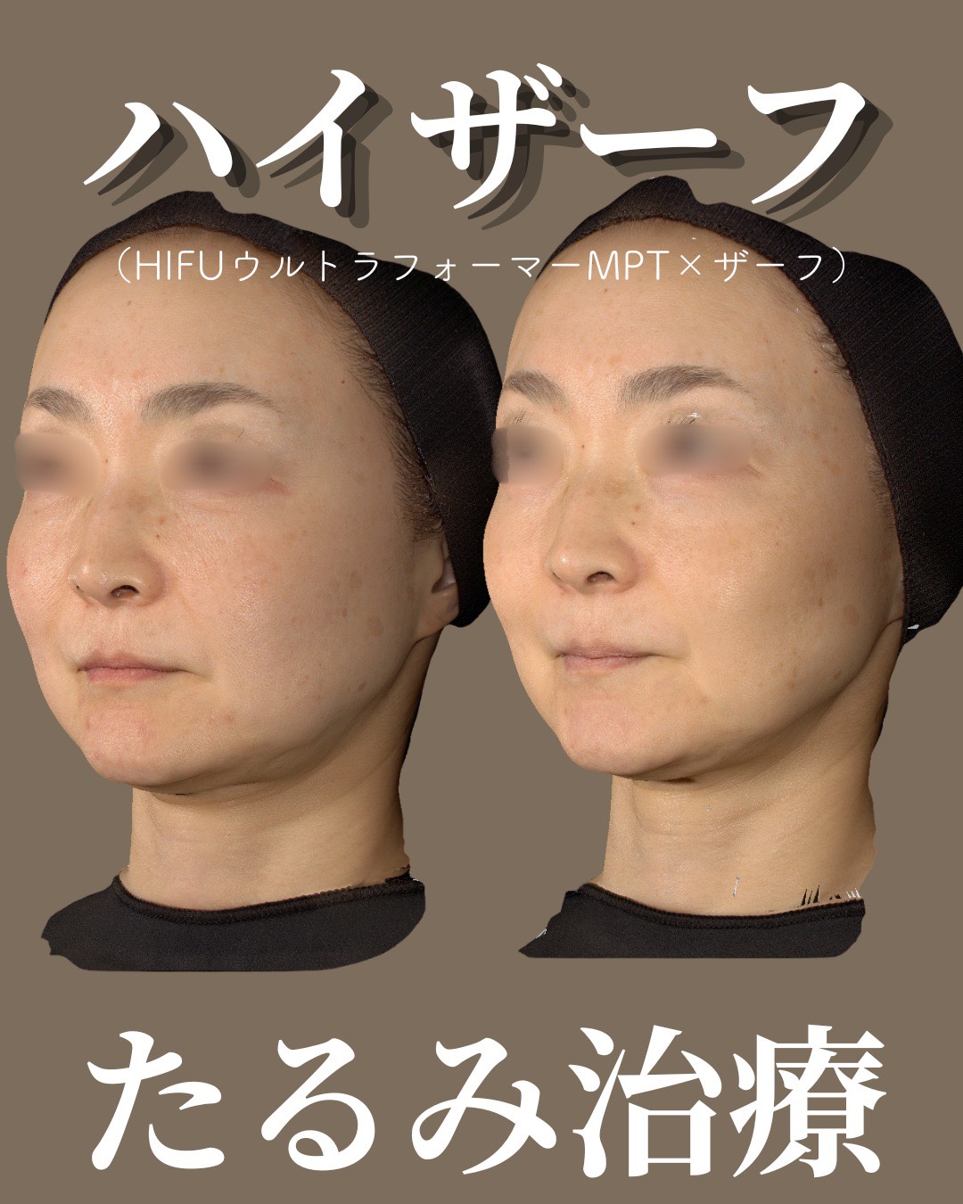 症例4