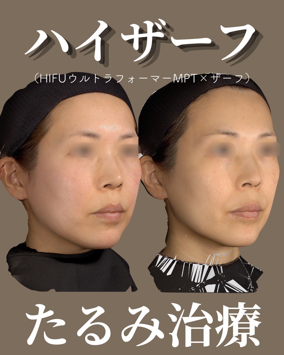 症例5