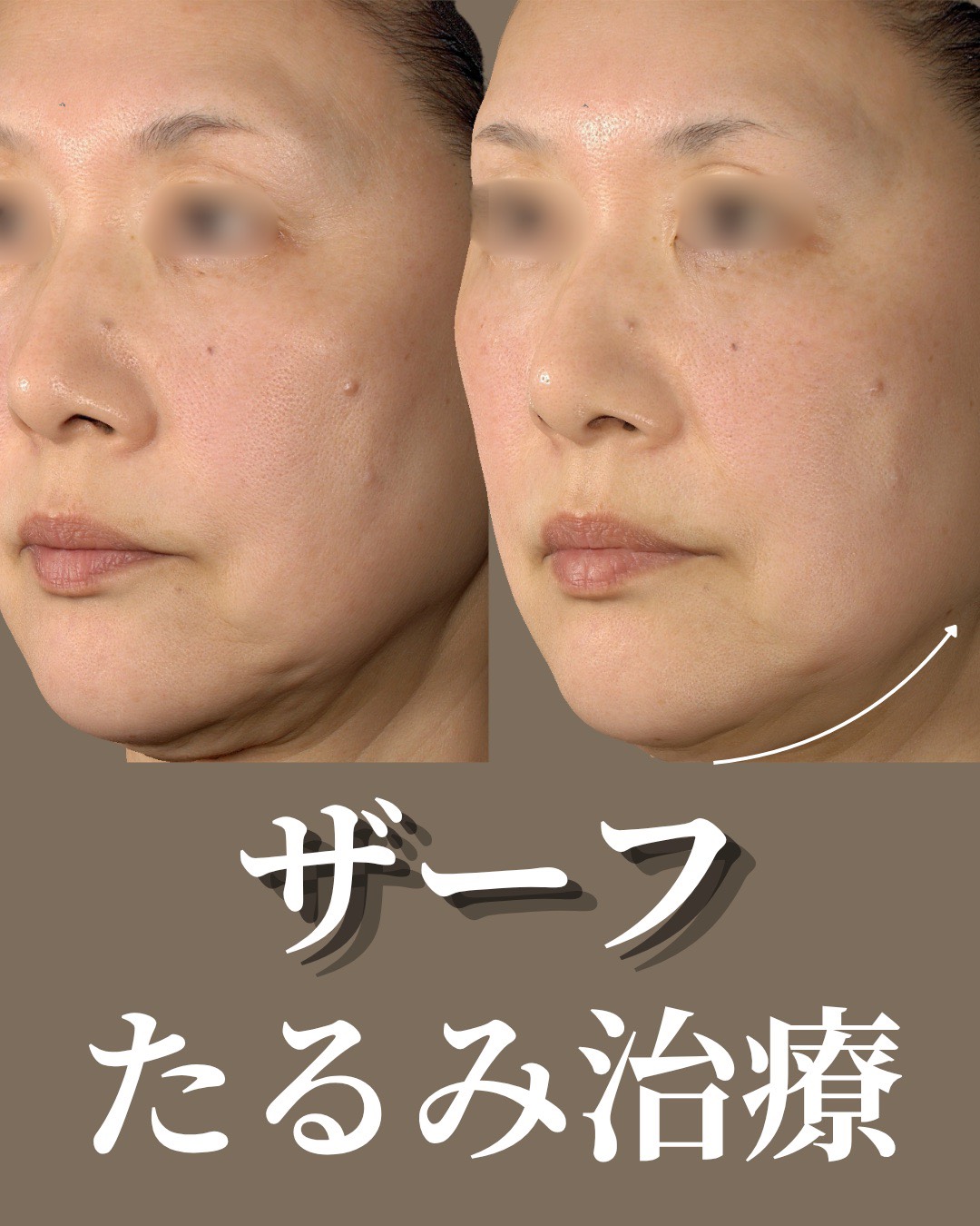 症例8