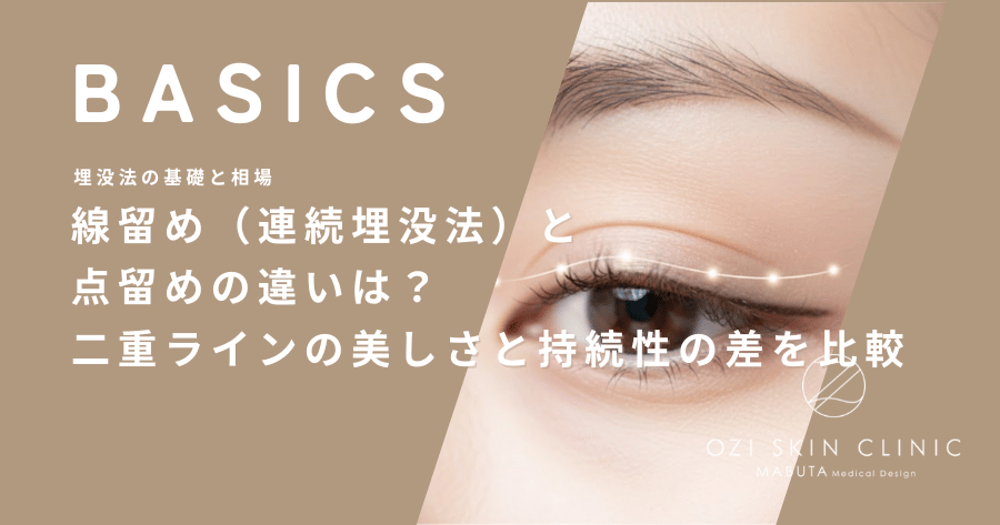 線留め（連続埋没法）と点留めの違いは？二重ラインの美しさと持続性の差を比較