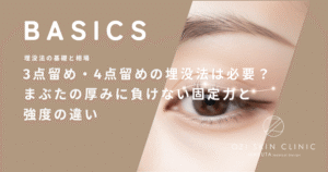 3点留め・4点留めの埋没法は必要？まぶたの厚みに負けない固定力と強度の違い