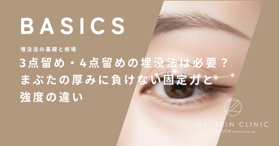 3点留め・4点留めの埋没法は必要？まぶたの厚みに負けない固定力と強度の違い