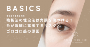 瞼板法の埋没法は角膜を傷つける？糸が眼球に露出するリスクとゴロゴロ感の原因