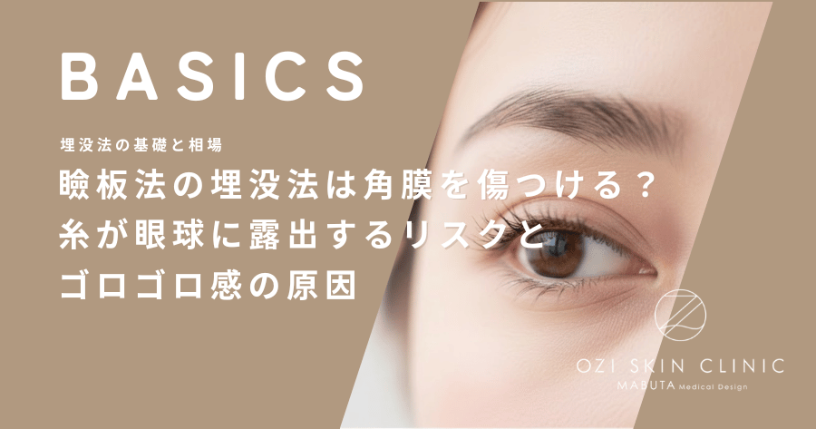 瞼板法の埋没法は角膜を傷つける？糸が眼球に露出するリスクとゴロゴロ感の原因