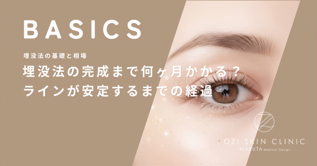 埋没法の完成まで何ヶ月かかる？二重幅が狭くなりラインが安定するまでの経過