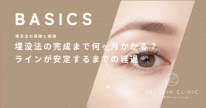 埋没法の完成まで何ヶ月かかる？二重幅が狭くなりラインが安定するまでの経過