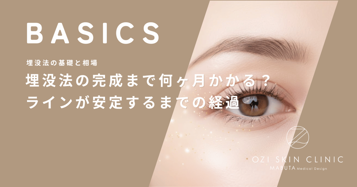 埋没法の完成まで何ヶ月かかる？二重幅が狭くなりラインが安定するまでの経過