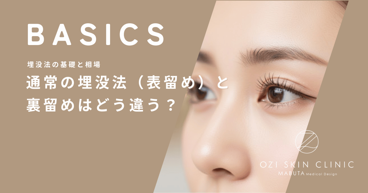 通常の埋没法（表留め）と裏留めはどう違う？仕上がりの美しさと持続性の比較