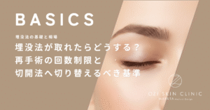 埋没法が取れたらどうする？再手術の回数制限と切開法へ切り替えるべき基準