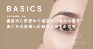 裏留めと表留めで埋没法の痛みは違う？まぶたの裏側への麻酔と術中の感覚