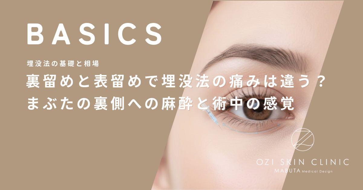 裏留めと表留めで埋没法の痛みは違う？まぶたの裏側への麻酔と術中の感覚