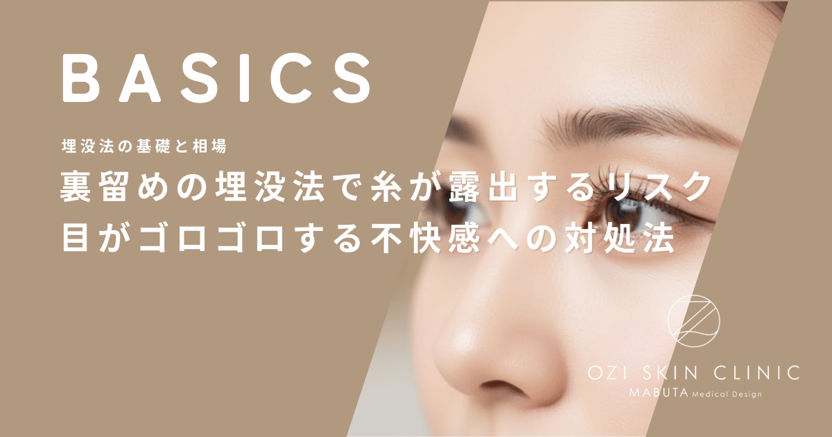 裏留めの埋没法で糸が露出するリスク｜目がゴロゴロする不快感への対処法
