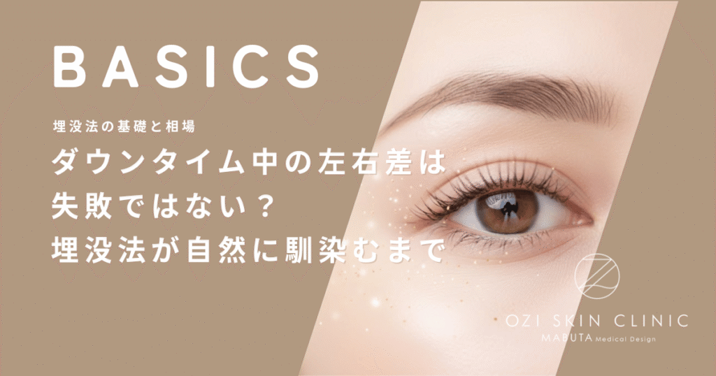 ダウンタイム中の左右差は失敗ではない？埋没法が自然に馴染むまでの全期間