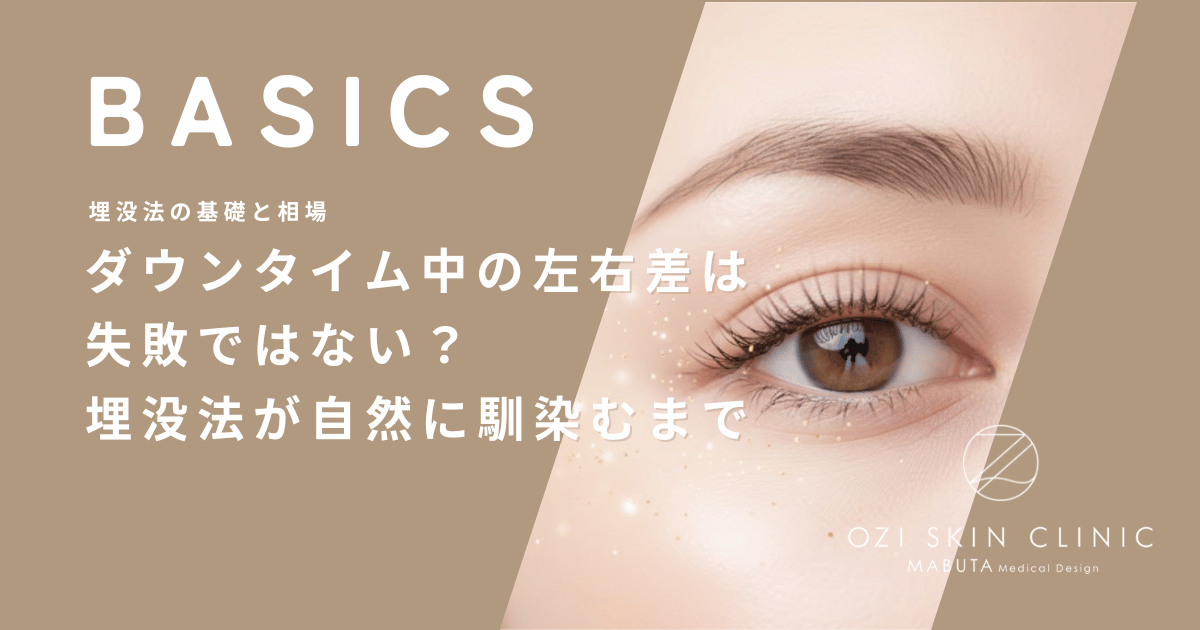 ダウンタイム中の左右差は失敗ではない？埋没法が自然に馴染むまでの全期間