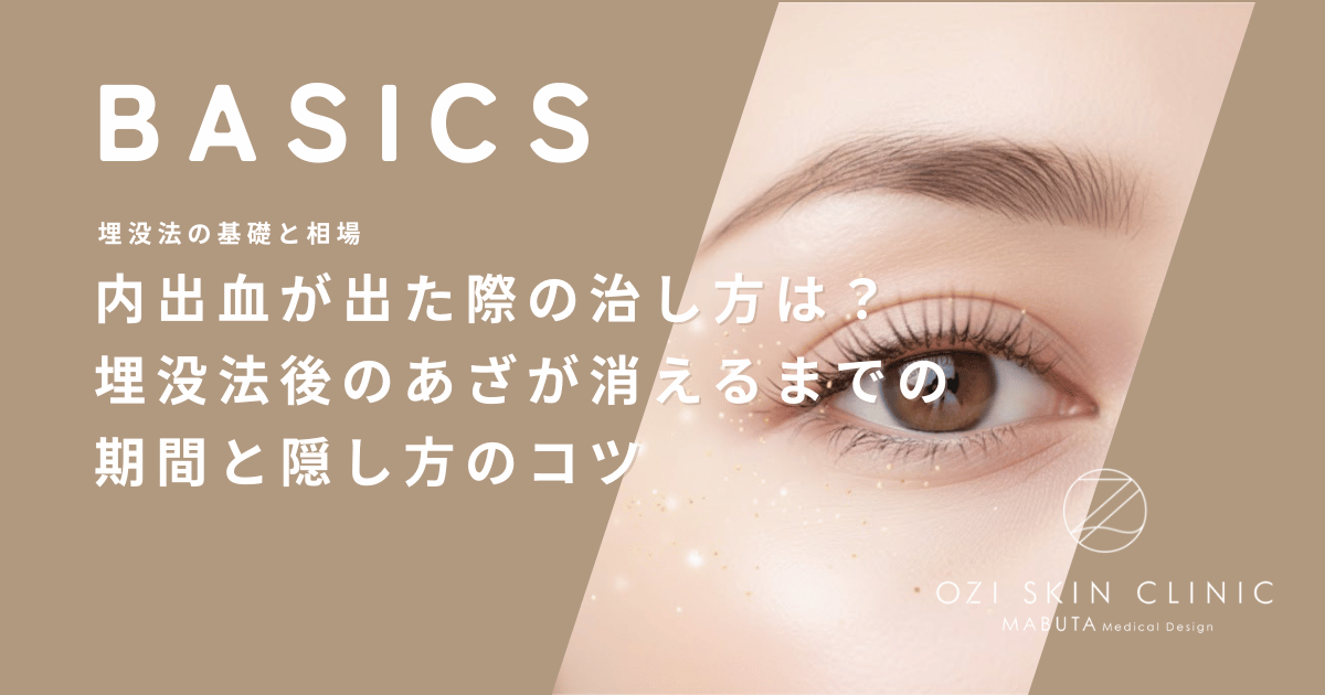 内出血が出た際の治し方は？埋没法後のあざが消えるまでの期間と隠し方のコツ