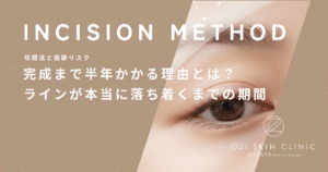 完成まで半年かかる理由とは？二重切開法のラインが本当に落ち着くまでの期間