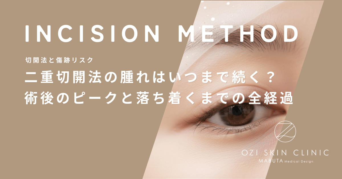 二重切開法の腫れはいつまで続く？術後のピークと落ち着くまでの全経過