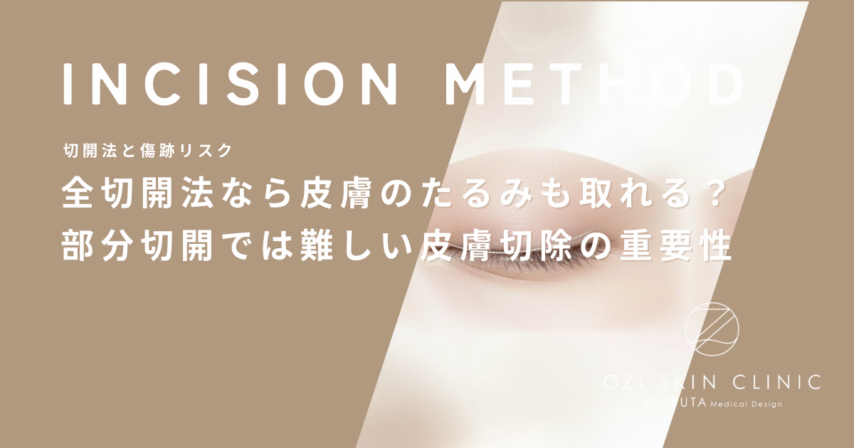 全切開法なら皮膚のたるみも取れる？部分切開では難しい皮膚切除の重要性を解説