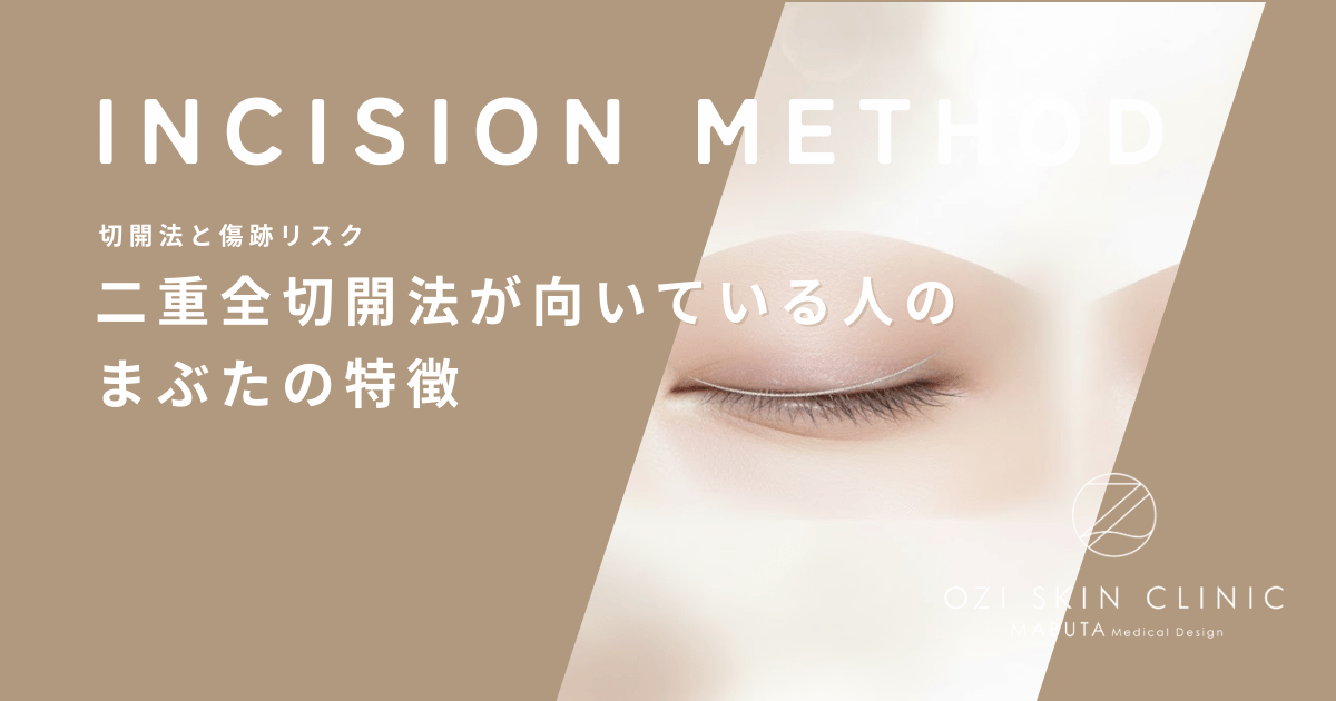 二重全切開法が向いている人のまぶたの特徴｜脂肪や皮膚のたるみが強いケースの適応