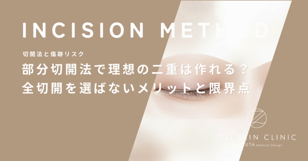 部分切開法（小切開）で理想の二重は作れる？全切開を選ばないメリットと限界点