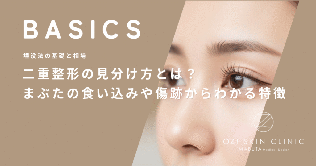 二重整形の見分け方とは？まぶたの食い込みや傷跡からわかる特徴を解説