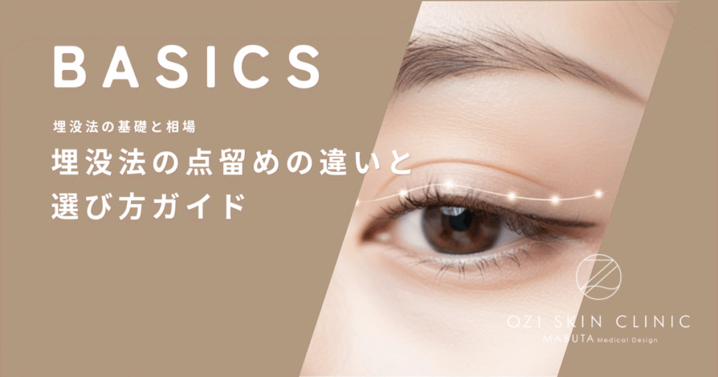 埋没法の点留め（1点・2点・3点・4点）の違いと選び方ガイド