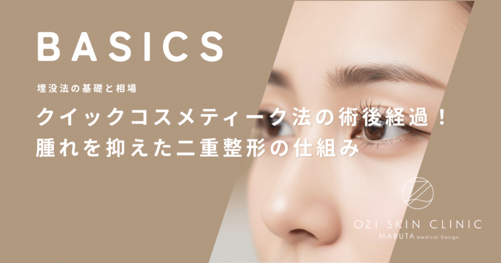 クイックコスメティーク法の術後経過！腫れを抑えた二重整形の仕組み