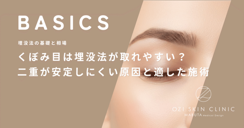 くぼみ目は埋没法が取れやすい？二重が安定しにくい原因と適した施術方法