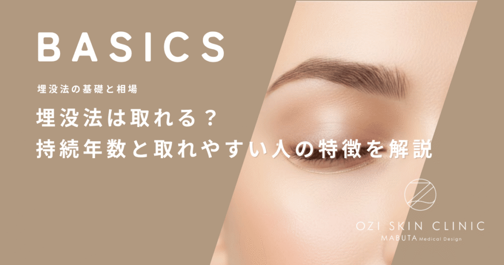 埋没法は取れる？持続年数と取れやすい人の特徴を解説