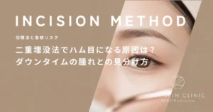 二重埋没法でハム目になる原因は？ダウンタイムの腫れとの見分け方