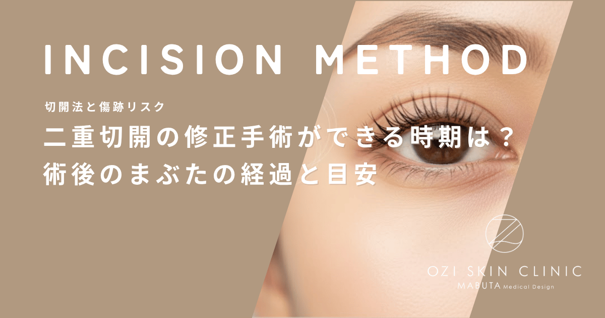 二重切開の修正手術ができる時期は？術後のまぶたの経過と目安