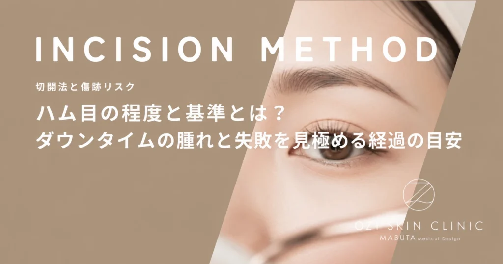ハム目の程度と基準とは？ダウンタイムの腫れと失敗を見極める経過の目安