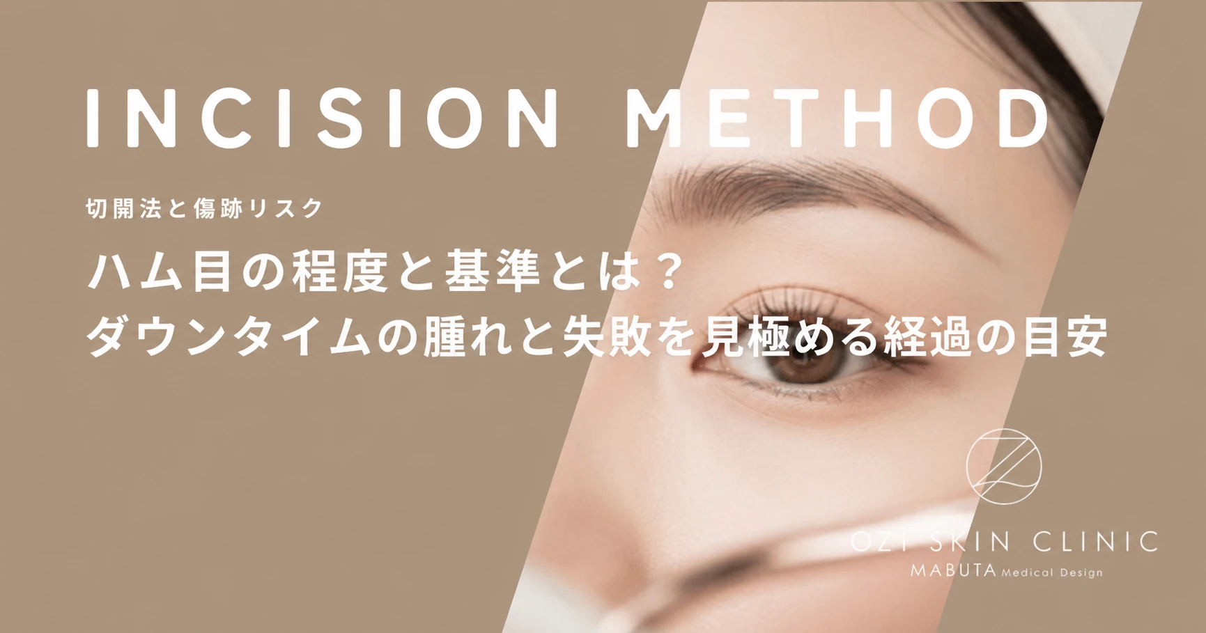 ハム目の程度と基準とは？ダウンタイムの腫れと失敗を見極める経過の目安