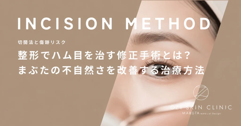 整形でハム目を治す修正手術とは？まぶたの不自然さを改善する治療方法