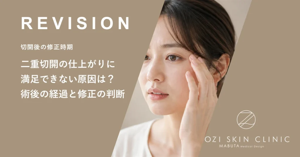 二重切開の仕上がりに満足できない原因は？術後の経過と修正の判断