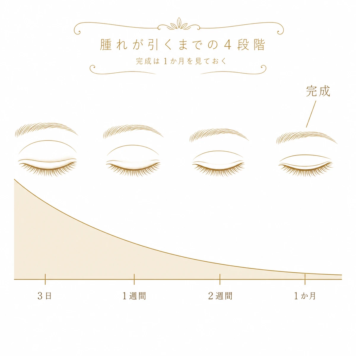 埋没法の腫れが3日・1週間・2週間・1か月と時間をかけて引いていく経過を、下る曲線と4つの目元で示した図解イラスト
