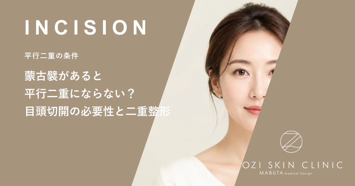 蒙古襞があると平行二重にならない?目頭切開の必要性と二重整形