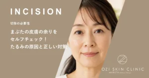 まぶたの皮膚の余りをセルフチェック！たるみの原因と正しい対策