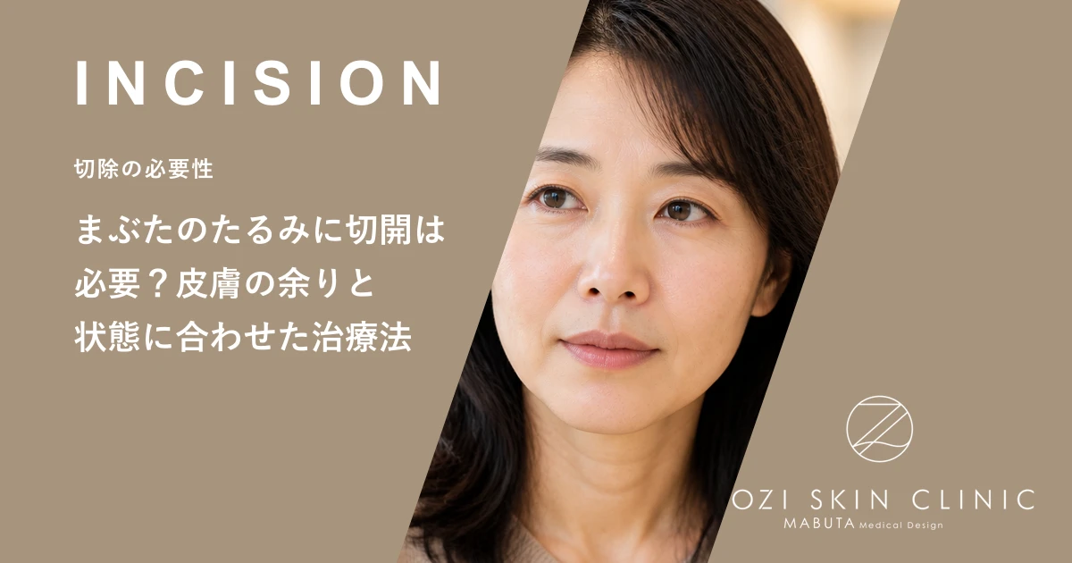 まぶたのたるみに切開は必要?皮膚の余りと状態に合わせた治療法
