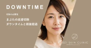 まぶたの皮膚切除のダウンタイム期間は？腫れを抑える術後の経過