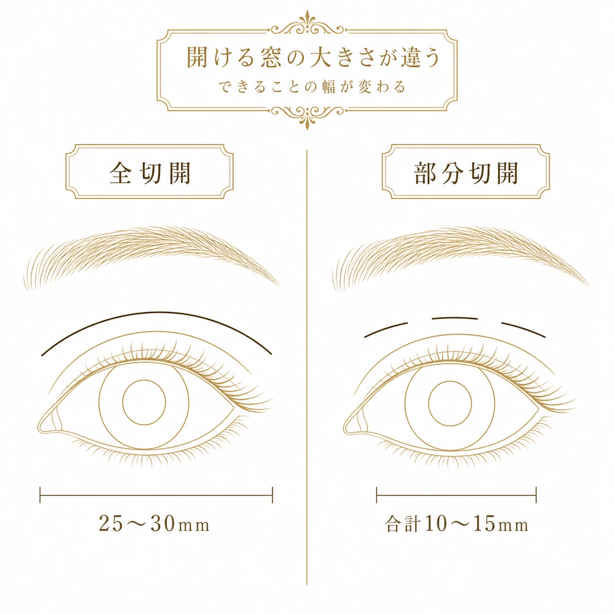 全切開と部分切開の切開線を目元に並べ、端から端までの1本と3つの短い線分という長さの違いを寸法線で示した図解イラスト