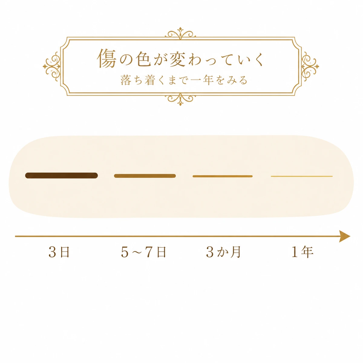 全切開の傷跡が3日から1年にかけて濃い線から淡い線へ変わっていくことを、時間軸の上に並べた4本の線で示した図解イラスト