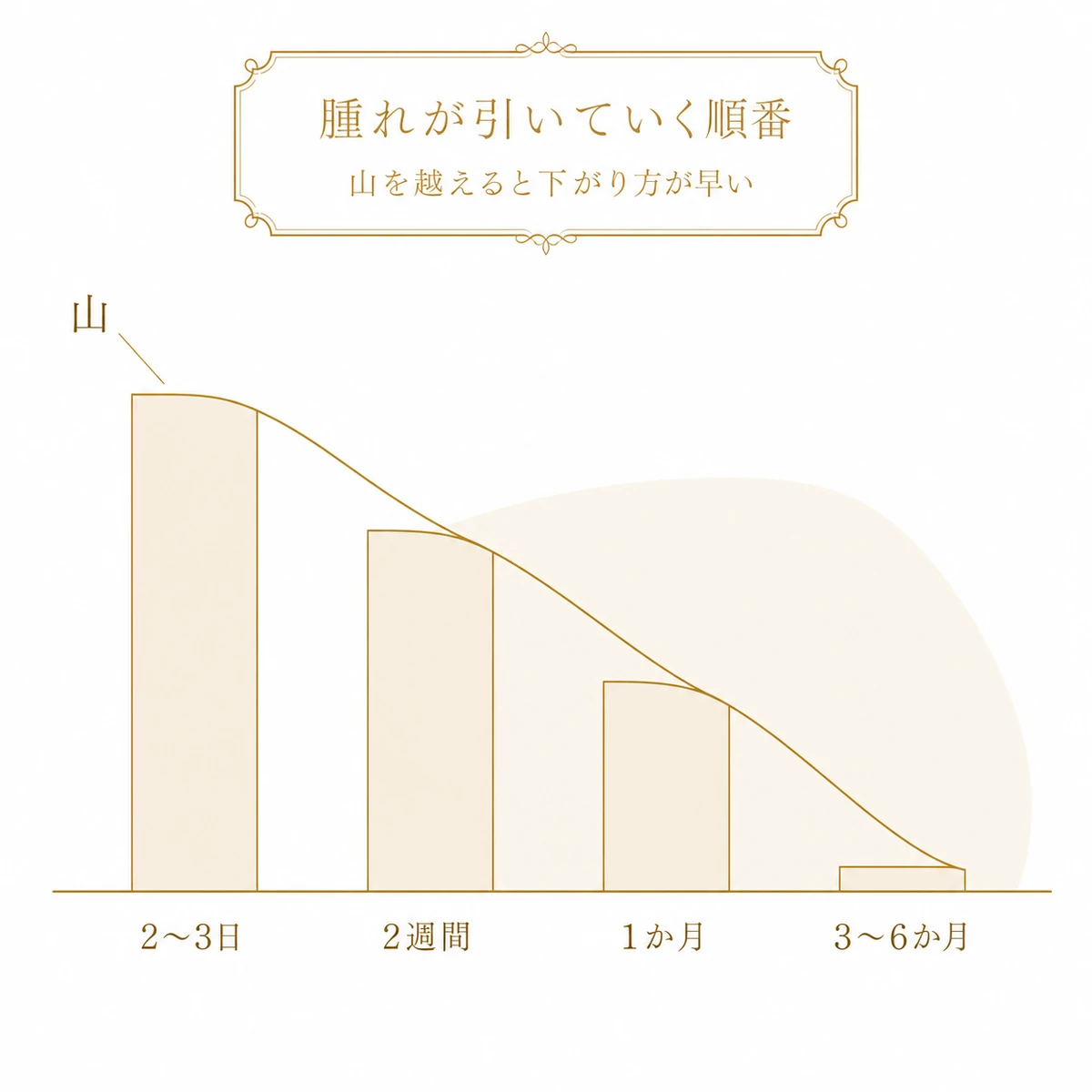 埋没法の腫れが2〜3日の山から2週間・1か月・3〜6か月へと段階的に引いていくことを、高さの下がる4本の帯で示した図解イラスト
