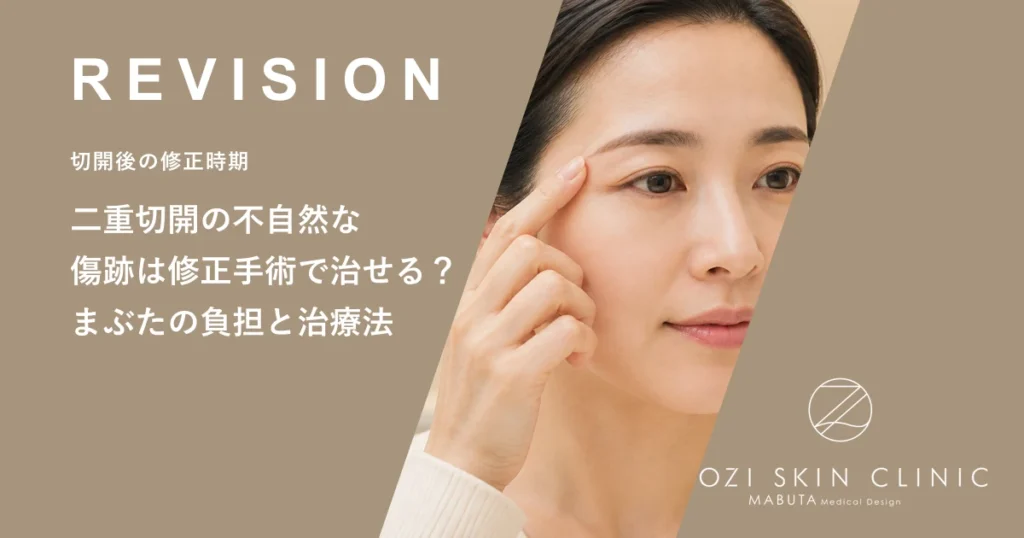 二重切開の不自然な傷跡は修正手術で治せる？まぶたの負担と治療法